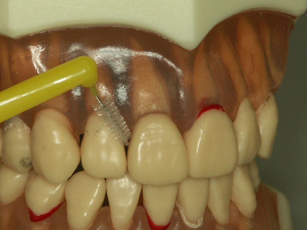 歯間ブラシの動かし方